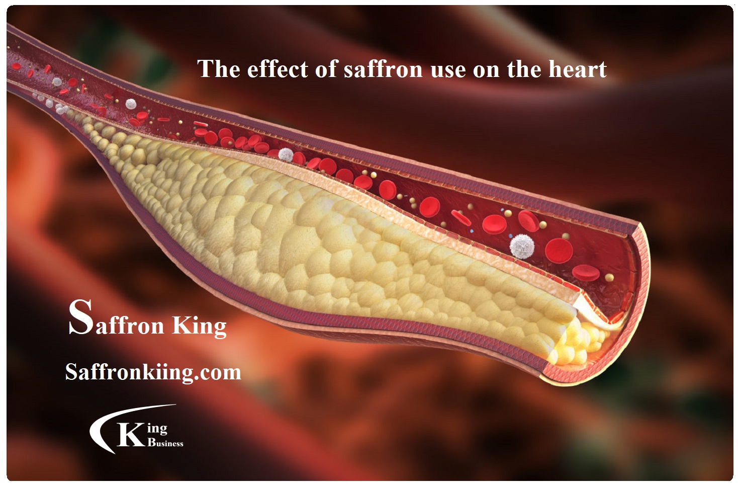 The effect of saffron use on the heart
